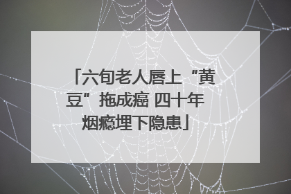 六旬老人唇上“黄豆”拖成癌 四十年烟瘾埋下隐患